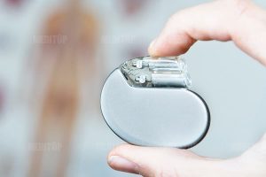 Giá máy tạo nhịp tim vĩnh viễn và máy 2 buồng